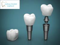 Sydney Dental Implant image 4